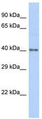 Zinc Finger Protein 875 antibody, TA343408, Origene, Western Blot image 