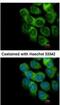 Thymidine Phosphorylase antibody, NBP1-31458, Novus Biologicals, Immunocytochemistry image 