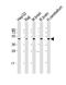 Guanine nucleotide-binding protein G(s) subunit alpha isoforms short antibody, M01243, Boster Biological Technology, Western Blot image 