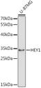 Hes Related Family BHLH Transcription Factor With YRPW Motif 1 antibody, A02454-1, Boster Biological Technology, Western Blot image 