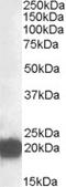 Cysteine And Glycine Rich Protein 3 antibody, EB09104, Everest Biotech, Western Blot image 