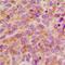 Stathmin 1 antibody, orb214179, Biorbyt, Immunohistochemistry paraffin image 