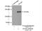 ArfGAP With GTPase Domain, Ankyrin Repeat And PH Domain 2 antibody, 14690-1-AP, Proteintech Group, Immunoprecipitation image 