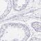 Tryptase Delta 1 antibody, PA5-59094, Invitrogen Antibodies, Immunohistochemistry frozen image 