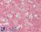 Collagen Type IV Alpha 2 Chain antibody, LS-B13713, Lifespan Biosciences, Immunohistochemistry paraffin image 