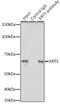 Keratin 5 antibody, GTX33140, GeneTex, Immunoprecipitation image 