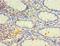 Cytochrome P450 Family 4 Subfamily F Member 12 antibody, LS-C379385, Lifespan Biosciences, Immunohistochemistry paraffin image 