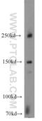 Nephrocystin 4 antibody, 13812-1-AP, Proteintech Group, Western Blot image 