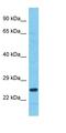 Chromosome 18 Open Reading Frame 21 antibody, orb326822, Biorbyt, Western Blot image 