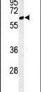 ClpB Homolog, Mitochondrial AAA ATPase Chaperonin antibody, PA5-26619, Invitrogen Antibodies, Western Blot image 