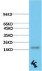 Transthyretin antibody, STJ98886, St John