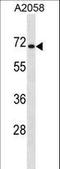 Cytoplasmic Polyadenylation Element Binding Protein 1 antibody, LS-C166987, Lifespan Biosciences, Western Blot image 