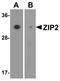 Zinc transporter ZIP2 antibody, A09140-1, Boster Biological Technology, Western Blot image 