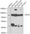 Glycosylphosphatidylinositol Specific Phospholipase D1 antibody, GTX33227, GeneTex, Western Blot image 