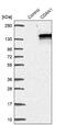 Codanin-1 antibody, NBP2-38473, Novus Biologicals, Western Blot image 