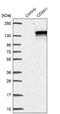 Codanin 1 antibody, NBP2-38473, Novus Biologicals, Western Blot image 