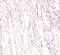 FUS RNA Binding Protein antibody, CSB-PA02704A0Rb, Cusabio, Immunohistochemistry paraffin image 