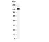 Solute Carrier Family 12 Member 1 antibody, R31289, NSJ Bioreagents, Western Blot image 