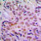 Checkpoint Kinase 2 antibody, LS-C353337, Lifespan Biosciences, Immunohistochemistry paraffin image 