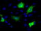 MCL1 Apoptosis Regulator, BCL2 Family Member antibody, LS-C115033, Lifespan Biosciences, Immunofluorescence image 