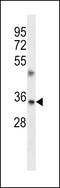 Transmembrane BAX Inhibitor Motif Containing 1 antibody, 56-884, ProSci, Western Blot image 