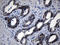 Receptor Tyrosine Kinase Like Orphan Receptor 2 antibody, M01840, Boster Biological Technology, Immunohistochemistry paraffin image 