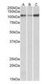 ATPase Sarcoplasmic/Endoplasmic Reticulum Ca2+ Transporting 2 antibody, orb153642, Biorbyt, Western Blot image 