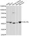 Calcitonin Receptor Like Receptor antibody, A8533, ABclonal Technology, Western Blot image 