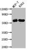 Histone Deacetylase 2 antibody, CSB-RA949799A0HU, Cusabio, Western Blot image 