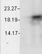 Crystallin Alpha B antibody, LS-C231290, Lifespan Biosciences, Western Blot image 