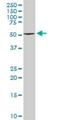 Tyrosinase antibody, H00007299-D01P, Novus Biologicals, Western Blot image 