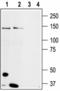 Transient Receptor Potential Cation Channel Subfamily M Member 8 antibody, BML-SA664-0050, Enzo Life Sciences, Western Blot image 