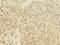 Tigger Transposable Element Derived 7 antibody, LS-C399327, Lifespan Biosciences, Immunohistochemistry paraffin image 