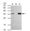 General Transcription Factor IIE Subunit 2 antibody, NBP2-20610, Novus Biologicals, Immunoprecipitation image 