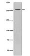 Leucine Rich Repeat Kinase 2 antibody, M00221-1, Boster Biological Technology, Western Blot image 