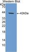 Amine Oxidase Copper Containing 1 antibody, abx101159, Abbexa, Enzyme Linked Immunosorbent Assay image 