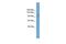 SKI Family Transcriptional Corepressor 1 antibody, GTX49082, GeneTex, Western Blot image 