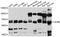 Glycine Receptor Beta antibody, abx125884, Abbexa, Western Blot image 