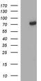 Methyltransferase Like 25 antibody, TA507325, Origene, Western Blot image 