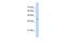 ST6 N-Acetylgalactosaminide Alpha-2,6-Sialyltransferase 6 antibody, GTX46382, GeneTex, Western Blot image 