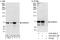 SAM And HD Domain Containing Deoxynucleoside Triphosphate Triphosphohydrolase 1 antibody, A303-690A, Bethyl Labs, Western Blot image 