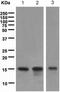 TNF Receptor Superfamily Member 12A antibody, ab109365, Abcam, Western Blot image 