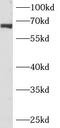 Ankyrin Repeat Domain 13C antibody, FNab00408, FineTest, Western Blot image 