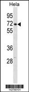 Cleavage And Polyadenylation Specific Factor 6 antibody, 60-961, ProSci, Western Blot image 