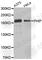 Pleckstrin Homology Domain Interacting Protein antibody, A3446, ABclonal Technology, Western Blot image 