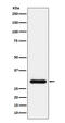 Natriuretic Peptide B antibody, M01186-2, Boster Biological Technology, Western Blot image 