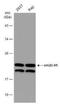 NME/NM23 Nucleoside Diphosphate Kinase 1 antibody, NBP1-30884, Novus Biologicals, Western Blot image 