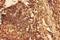 CFL1 antibody, LS-C313428, Lifespan Biosciences, Immunohistochemistry paraffin image 