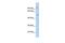 Gap Junction Protein Alpha 3 antibody, GTX47482, GeneTex, Western Blot image 