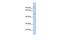 Gap Junction Protein Alpha 3 antibody, GTX47482, GeneTex, Western Blot image 